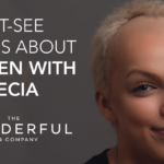3 Must-See Videos About Women With Alopecia