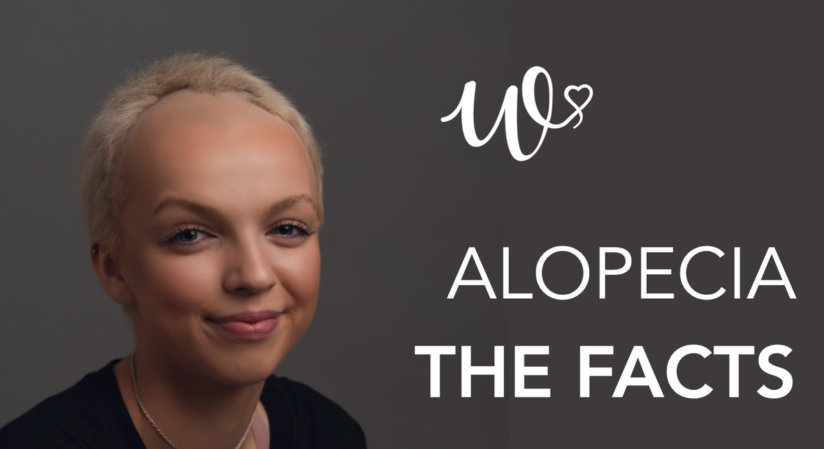 Alopecia – The Facts!